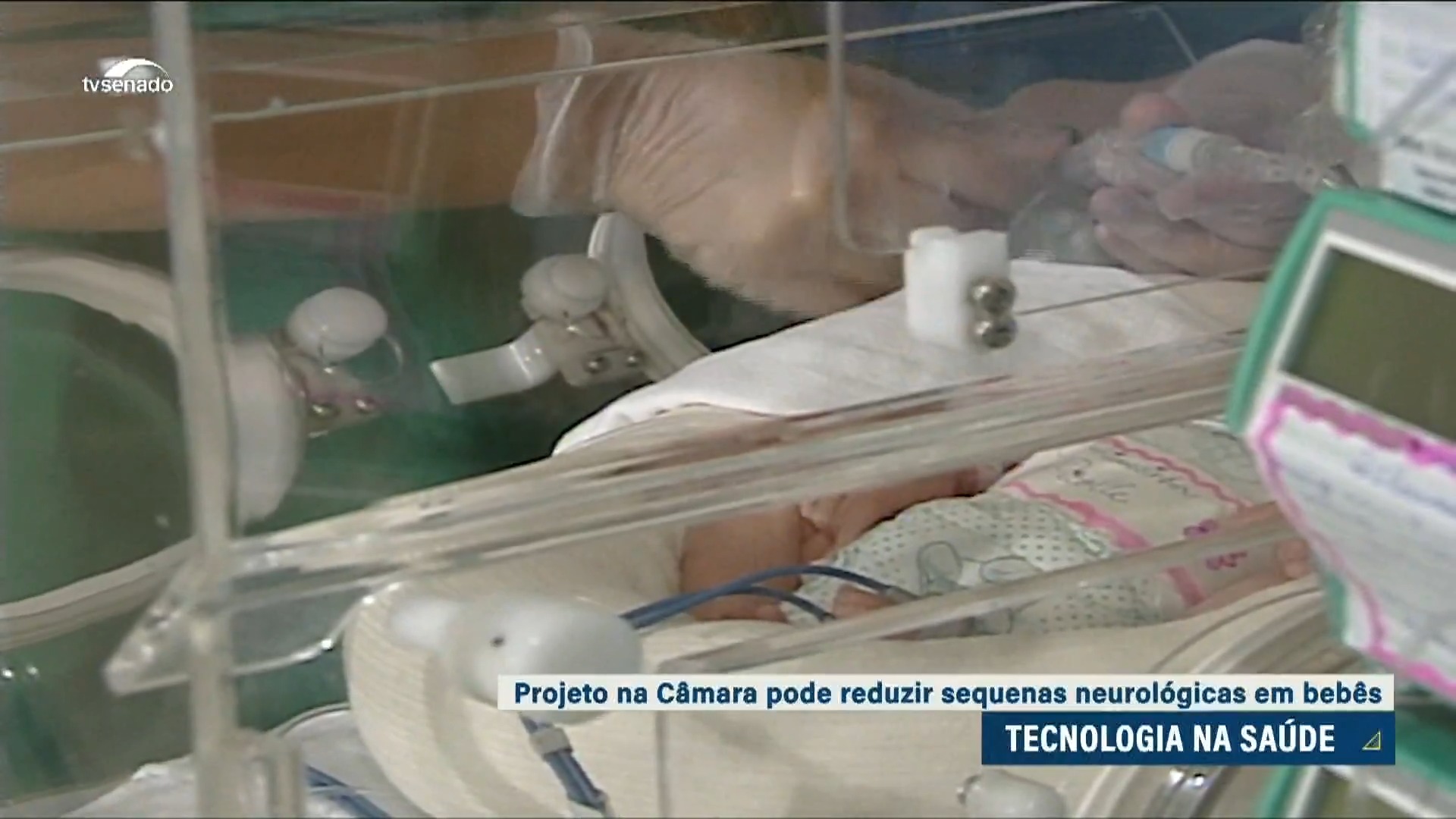Vídeo: Debatedores pedem monitoramento neurológico em recém-nascidos